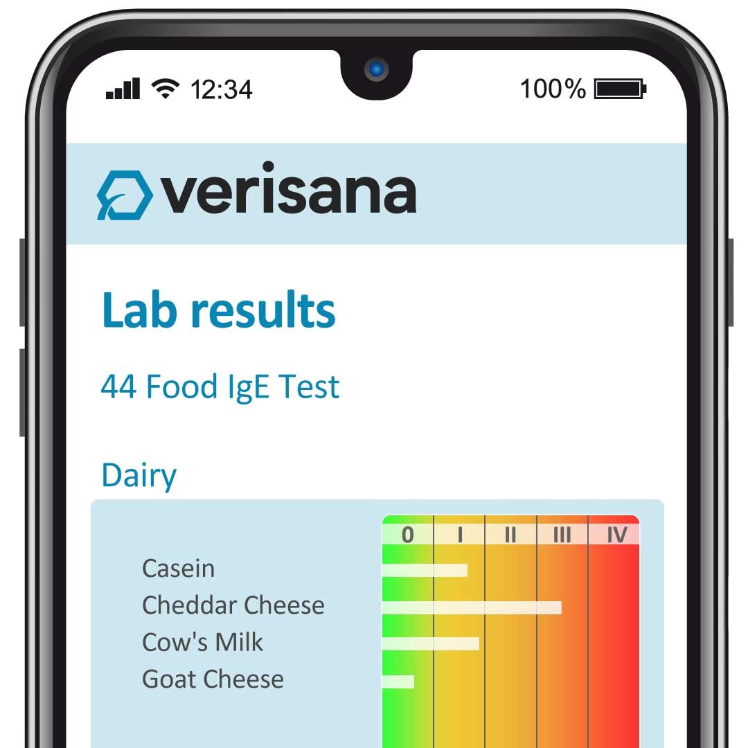 Food Allergy Test 44 Foods V727524